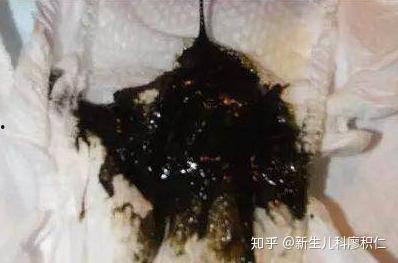 成人拉屎正常的图片视频,正常拉屎的图片与视频解析